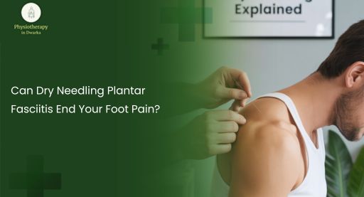 Dry Needling Plantar Fasciitis